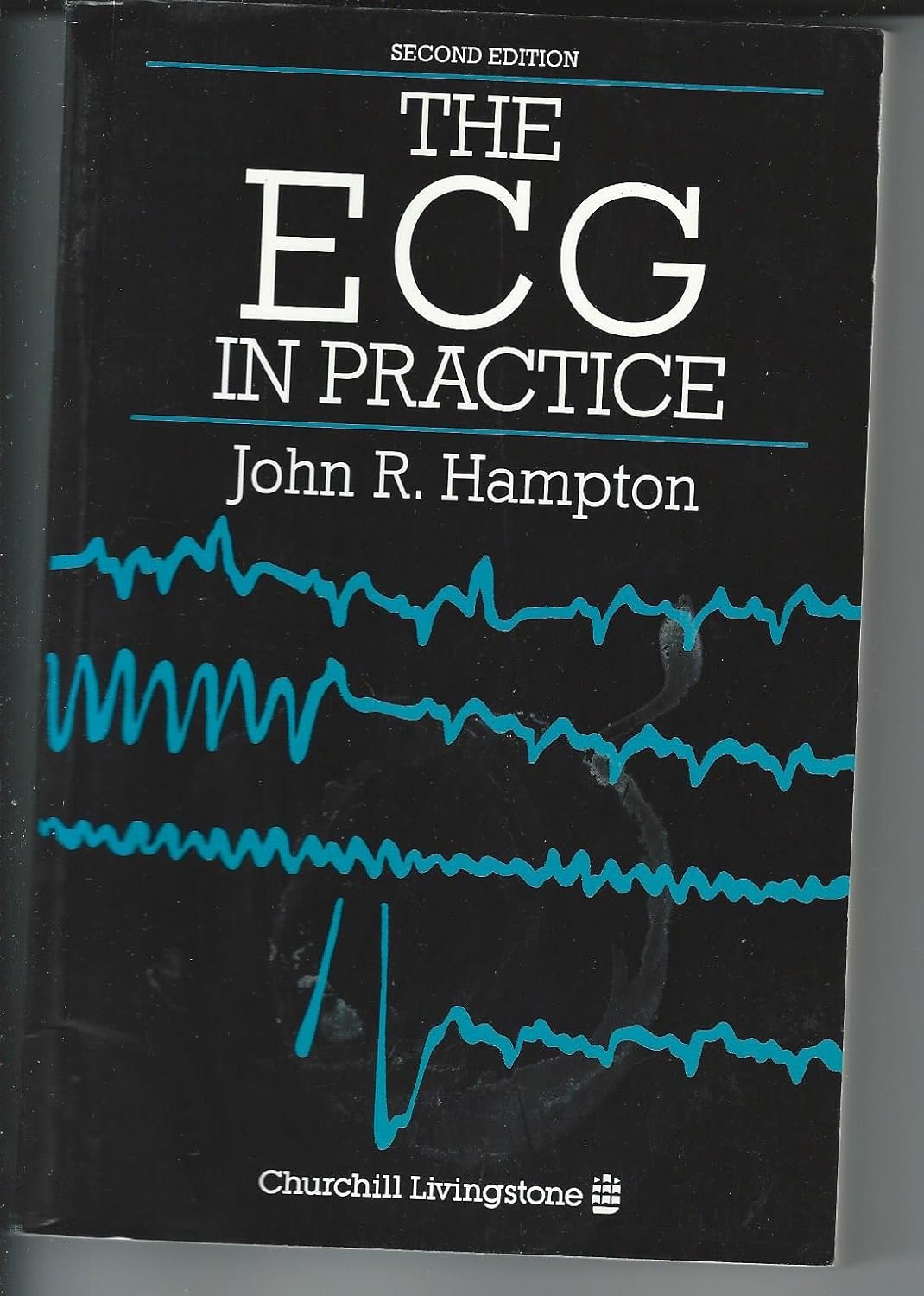 The Ecg in Practice