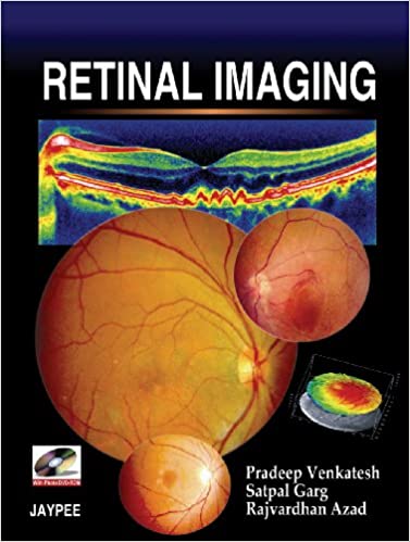 Retinal Imaging - (HB)